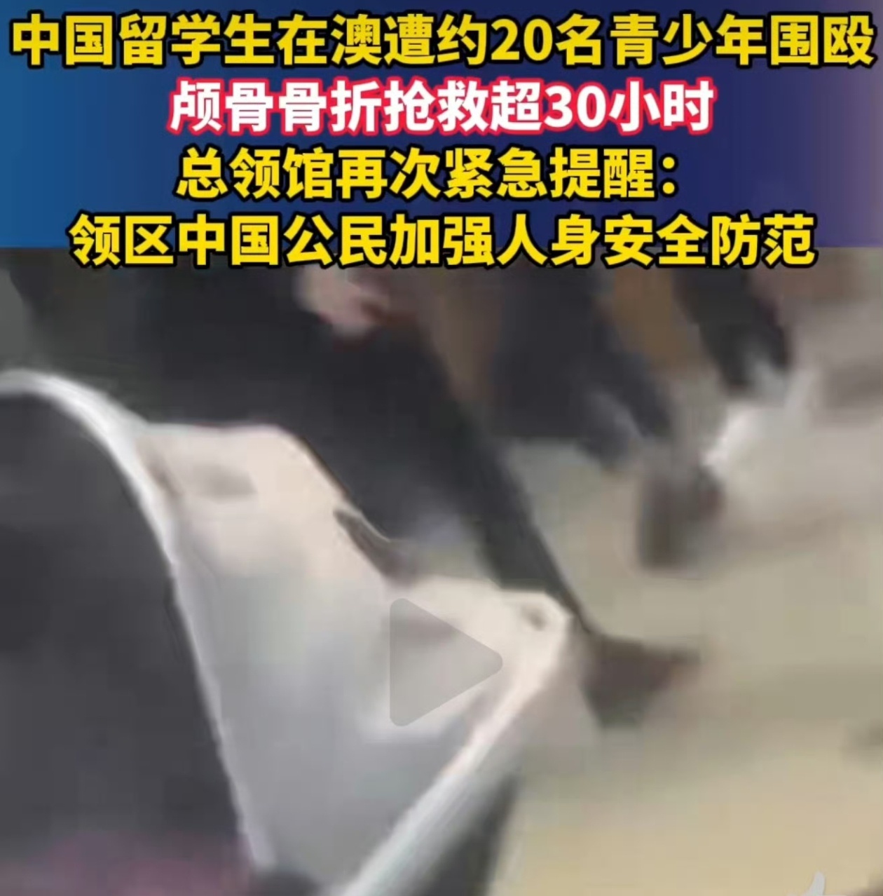 中国留学生在澳遭围殴抢救超30小时澳大利亚，是罪犯流放之地，所以还是国内更安全！