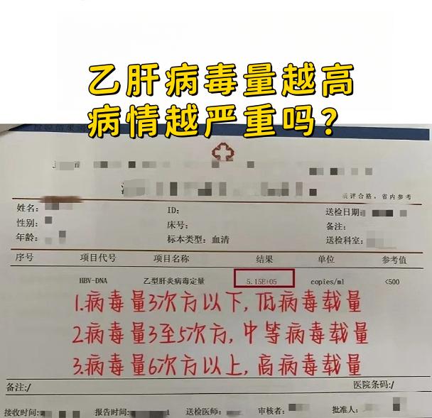 乙肝病毒量越高，病情越严重吗?。1、病毒量3次方以下，低病毒载量 2...