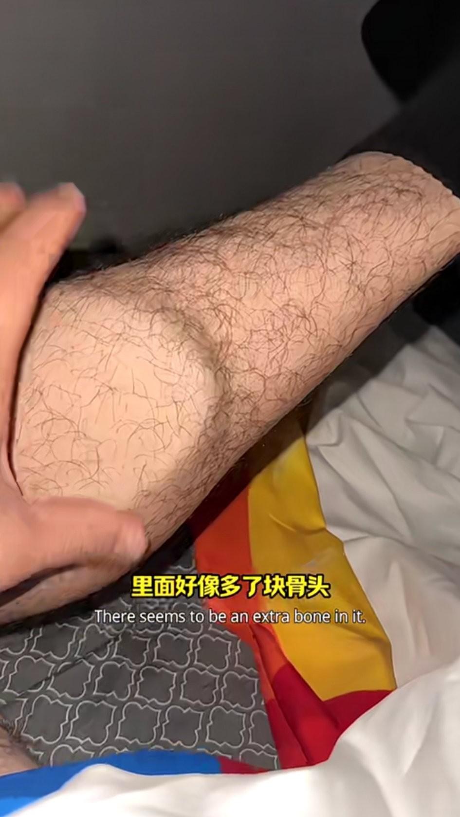 家人们，谁懂呀？下午踢了会儿足球，腿就成这样了，硬邦邦的，感觉里面像多了块骨头！