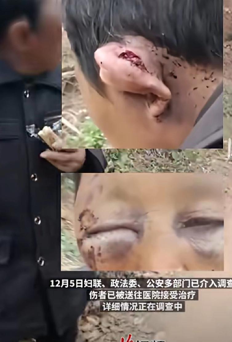 就不知道跑吗？12月4日，湖南平洲有网友发布视频称:一女子被丈夫多次家暴打成“弱