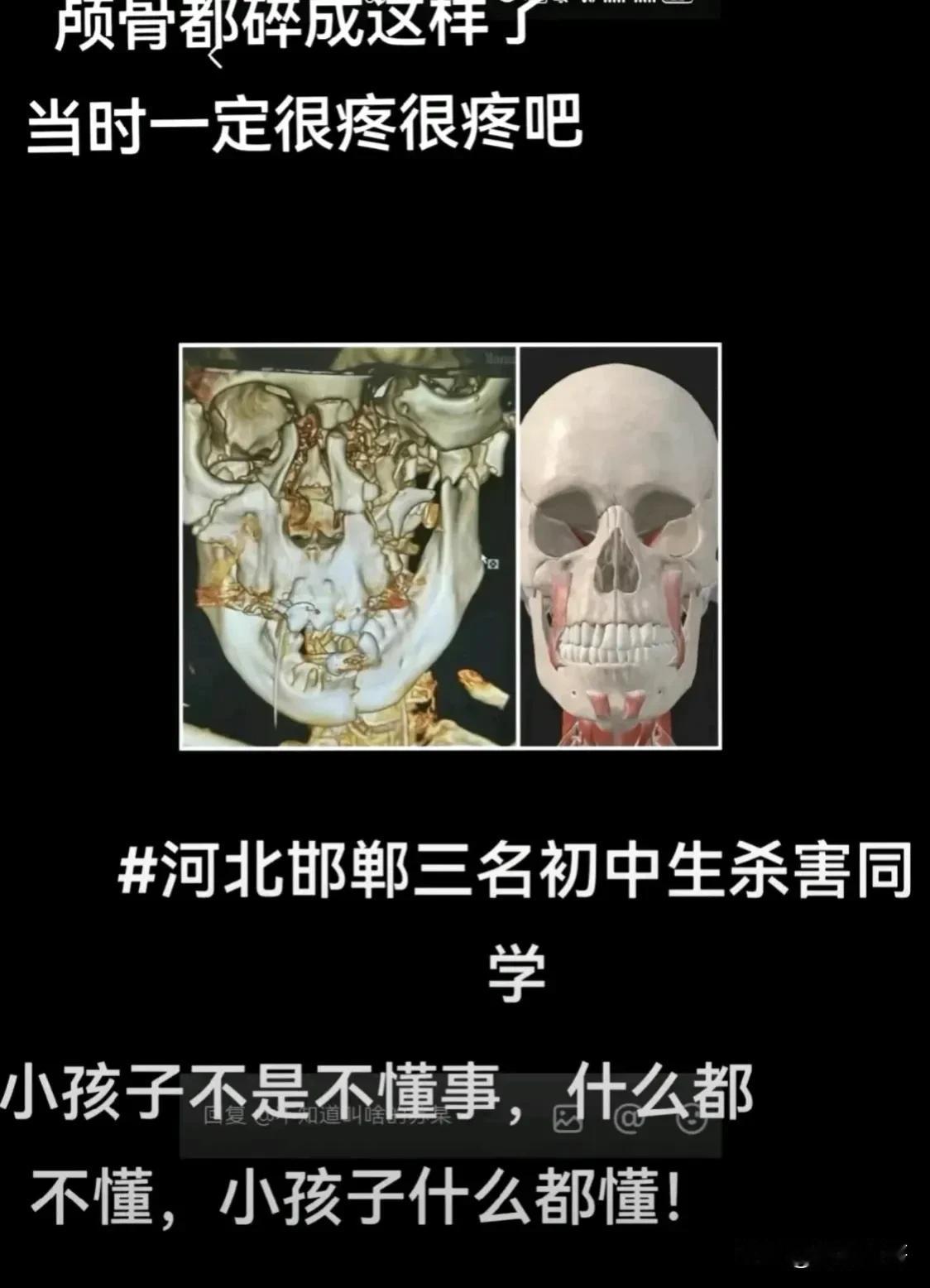 有两个疑点，一是埋人的坑据说有2米深，光靠三个孩子的力量我觉得办不到，二是想不通