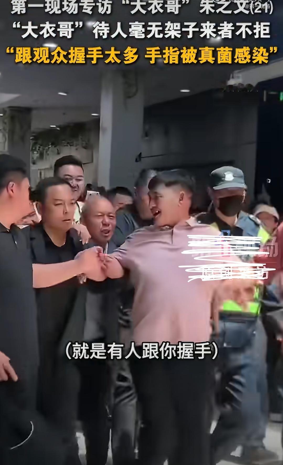 大衣哥曝跟人握手太多致真菌感染大衣哥这也太实在，太心软了。谁能想到啊，就因为待人