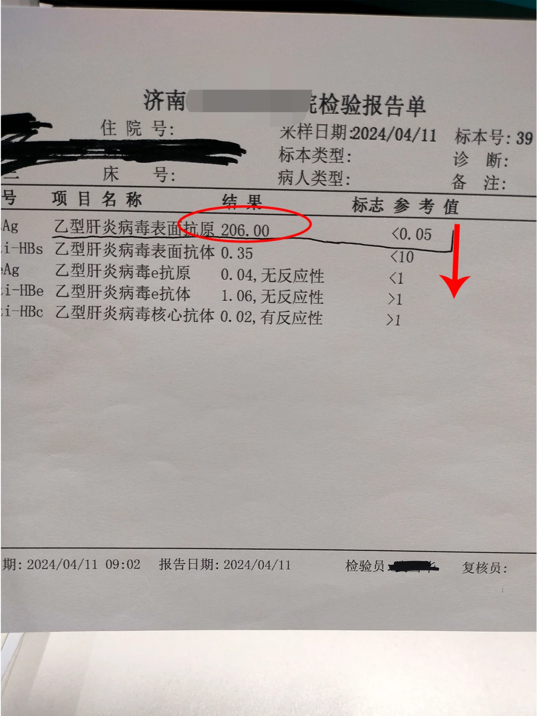 说说乙肝抗病毒3年，表面抗原200多能转阴吗