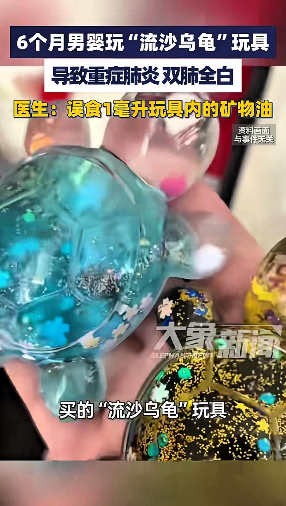 6个月男婴玩“流沙乌龟”玩具导致重症肺炎，双肺变白。
郑州这事件太吓人了！一个6