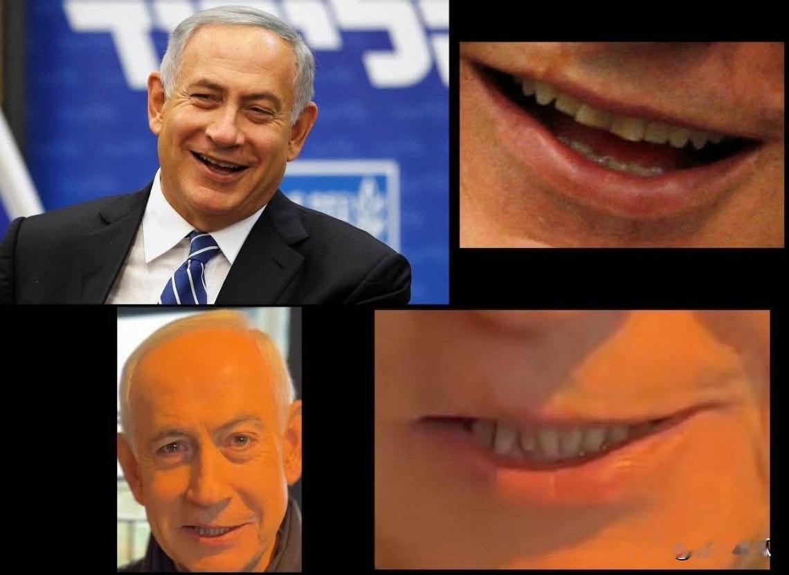 细心网友发现，在咖啡店侃侃而谈的内塔尼亚胡有小猫牙，而以往的内塔尼亚胡是大平牙，