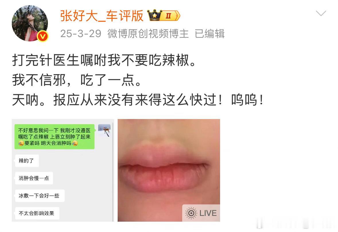 上峰哥节目前来找董大上了点科技。上次麻药过敏所以这次麻药只敷了15分钟。扎💉的