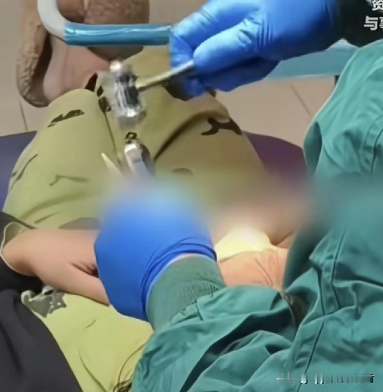 简直丧心病狂啊！一个53岁的女子，去医院牙科看牙。结果，被一个无良医生，一次性拔