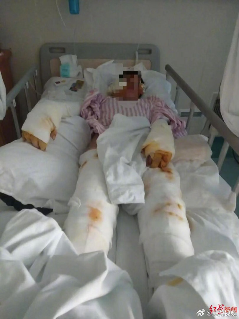 #女司机拒绝顺风车乘客求爱被捅十几刀#【41岁男子坐顺风车向31岁女司机求爱遭拒