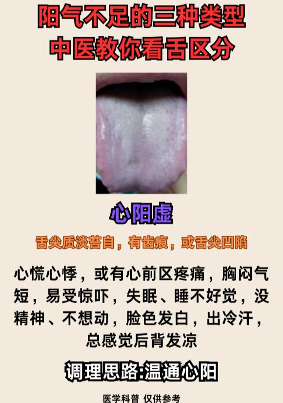 阳气不足分 3 种：心阳虚、脾阳虚、肾阳虚，看舌就能分清