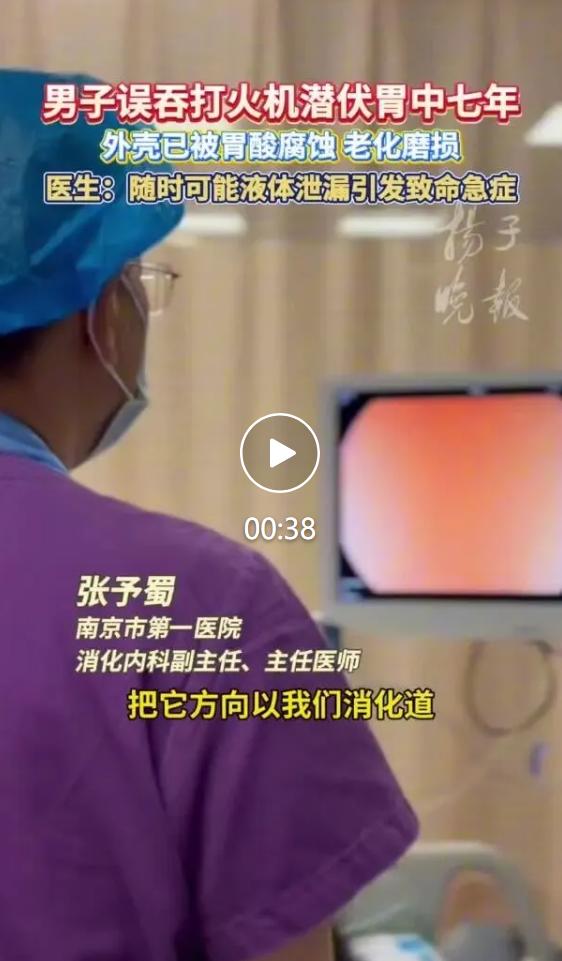 33 岁王先生（化名）七年前不慎误吞打火机，因初期身体无异常便未就医干预；202