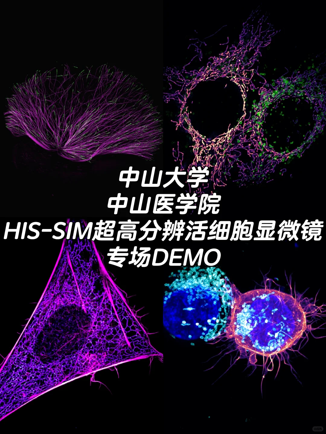 线粒体拍摄利器|中山医学院＊专场DEMO