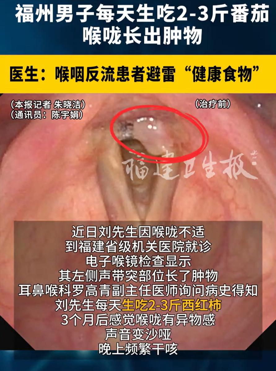 “担心的事情发生了！”福州，一60岁男子最近突然咳嗽的厉害，开始还以为是感冒了，