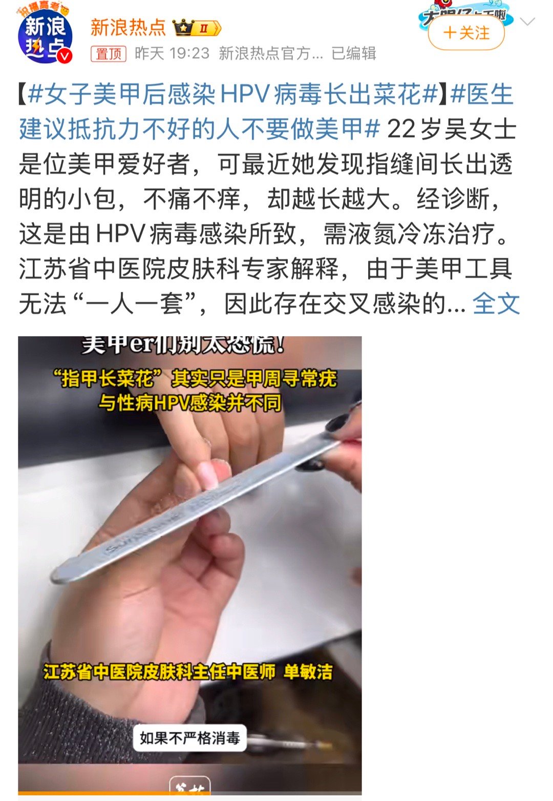 女子美甲后感染HPV病毒长出菜花 近日，“女子美甲后感染HPV病毒长出菜花”的新