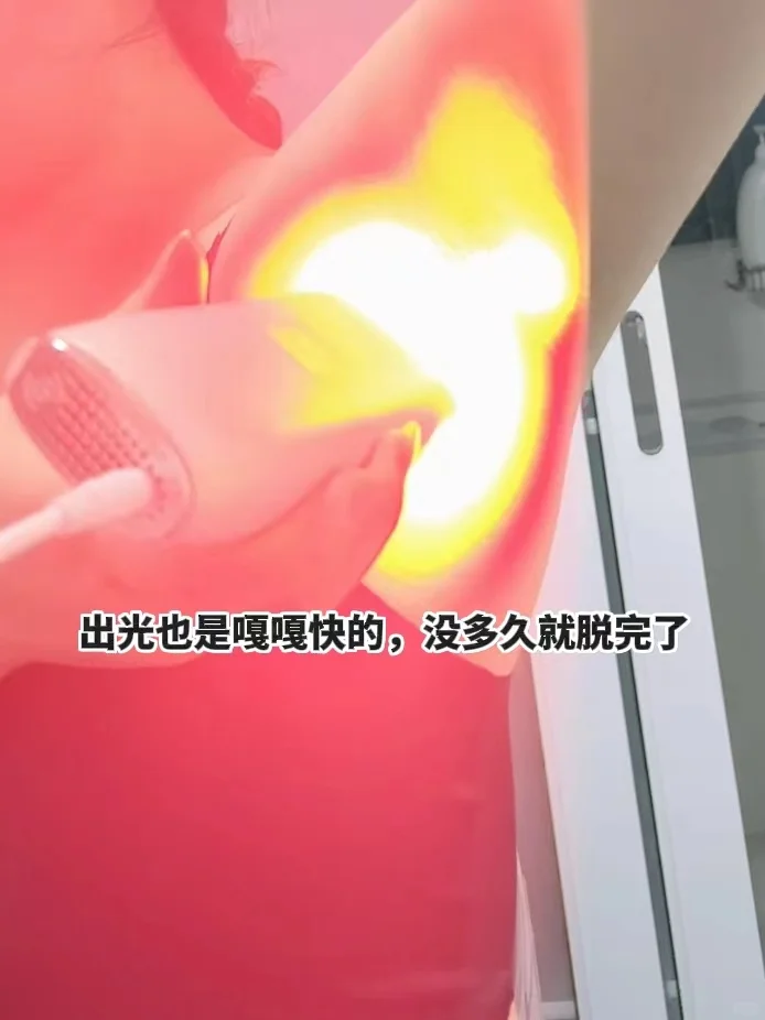 某科室（已离职）才敢聊脱毛仪脱毛的区别