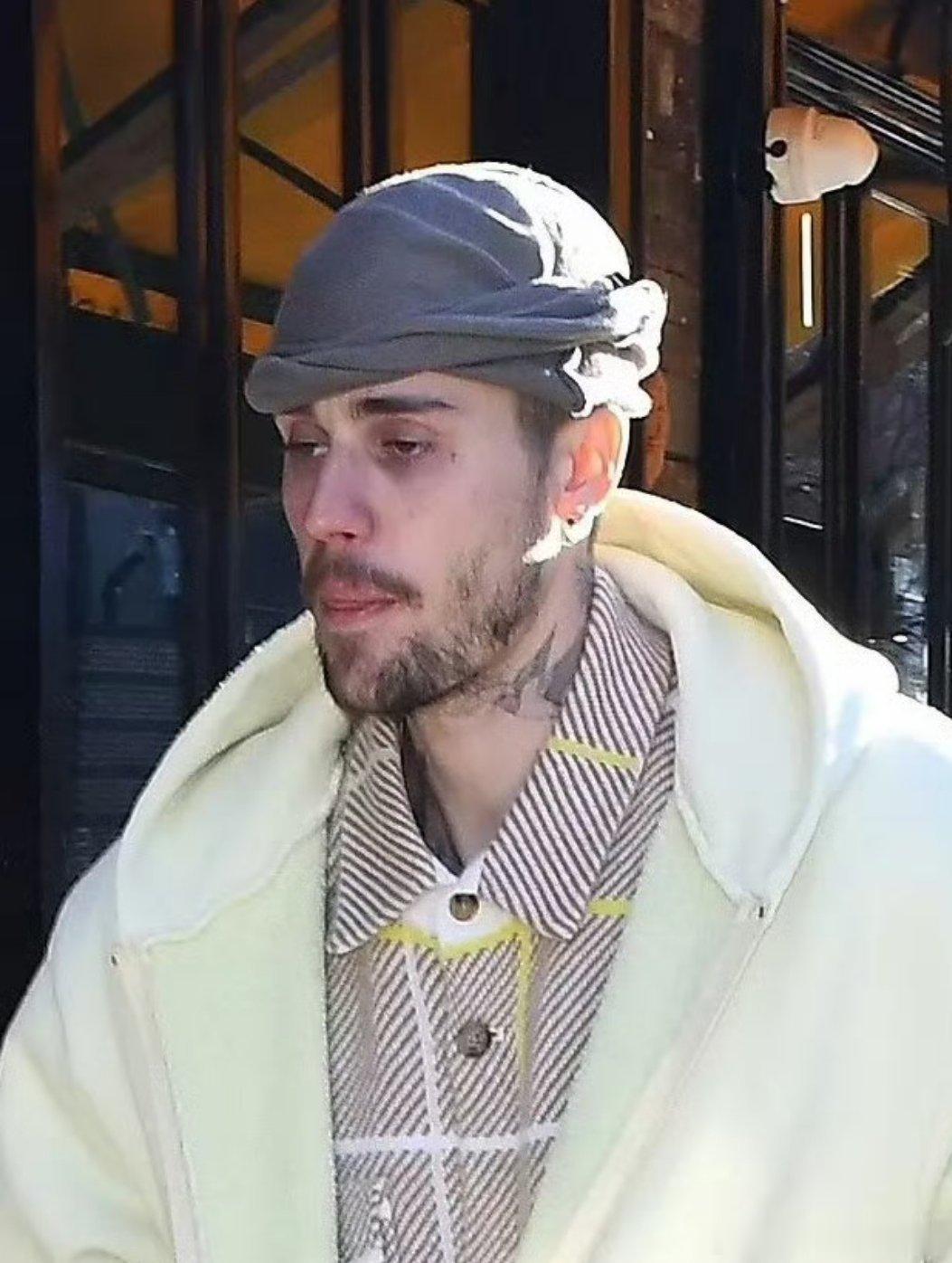 曝贾斯丁比伯健康状况堪忧 我的天怎么成这样了[哆啦A梦害怕]但是粉丝澄清昨天还打