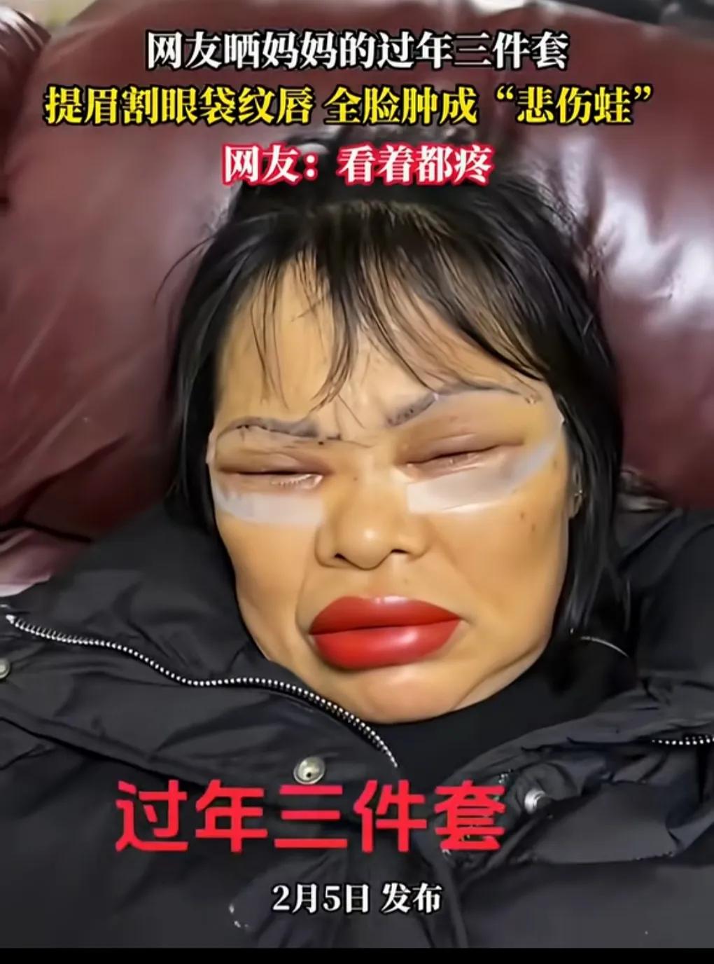 网友晒出爱美的妈妈，想美美哒过年，给自己定制三件套，纹唇，割眼袋，提眉。

做完