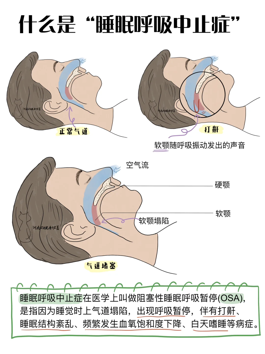 🆘打呼噜真的千万要注意‼️