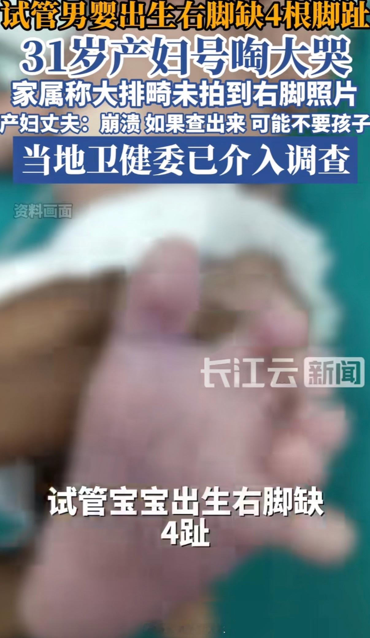 试管婴儿右足畸形官方将通报这也是很多人为什么在公立医院做了四维之后又非要去私立再