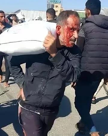 巴勒斯坦加沙地带，一个满脸鲜血的男子，肩膀上扛着一袋抢来的粮食，家人们终于不用忍