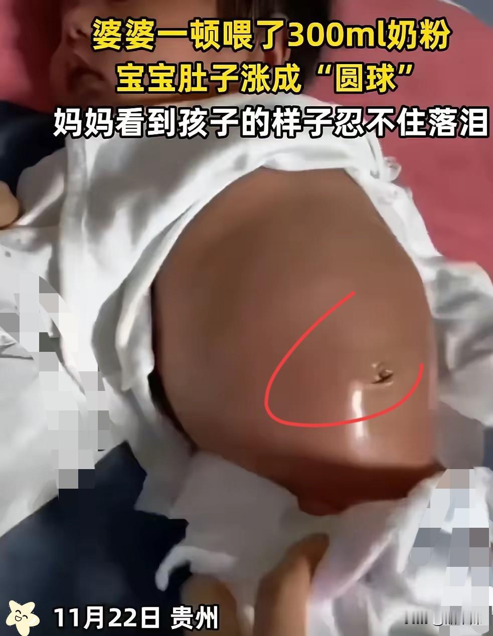 贵州， 一宝妈去买菜，把孩子交给奶奶带，娃就被婆婆灌了300毫升奶粉，
小肚皮撑