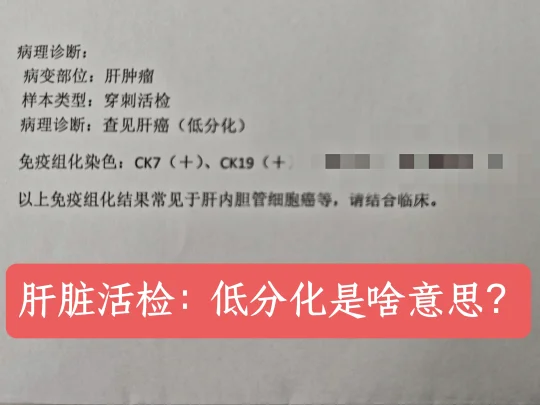 上个星期因为肝疼的厉害，去了医院，查出来是肝癌。 住院后又做了肝穿刺...