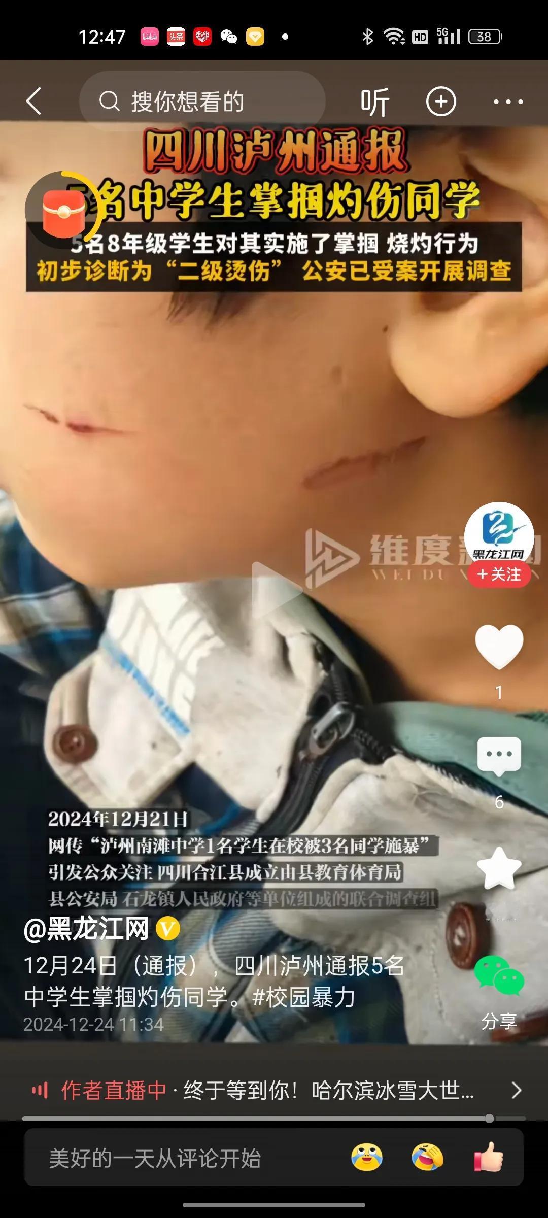 四川泸州又现校园霸凌事件！
五名八年级学生掌捆，灼烧一名学生，经鉴定为二级灼伤！