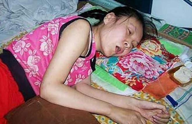 2008年，瘫痪了20年的河北女孩竟然在家里站起来了。面对家人询问，她一问三不知