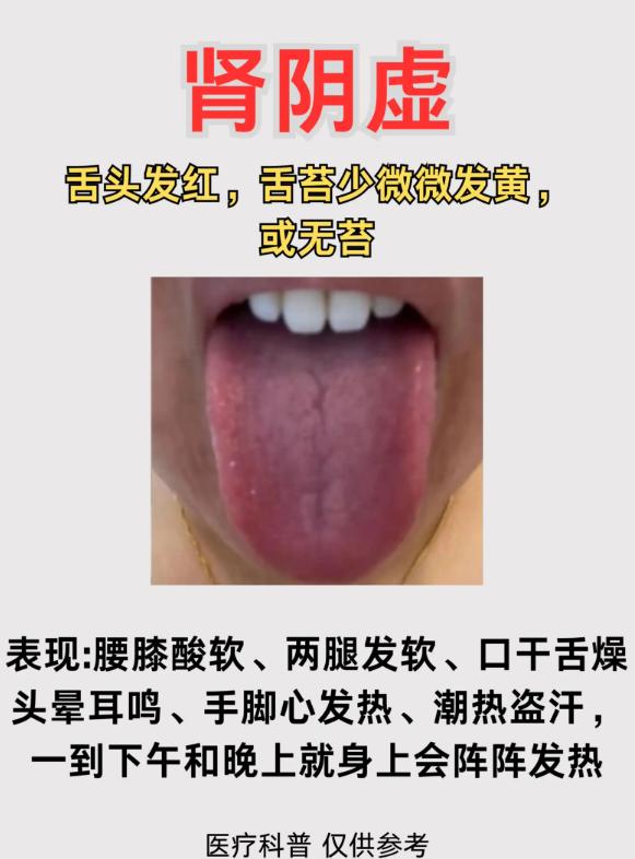 3 种肾虚类型，从舌象就能分辨清楚