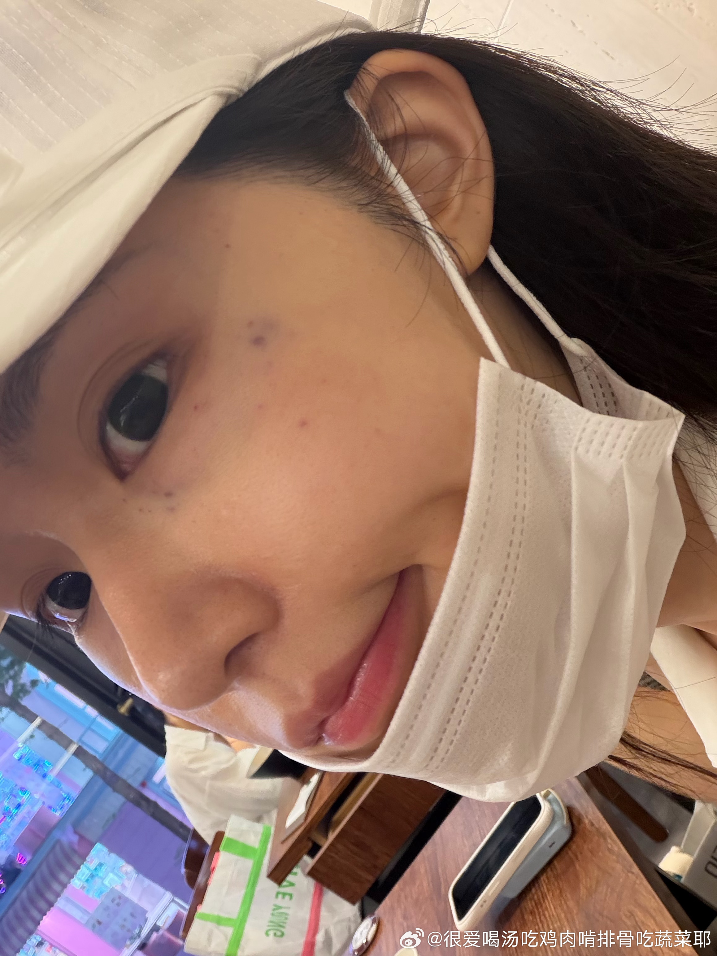 前天手针打了眼周水光 现在肿的还像刚嘎完眼袋  一会儿要去拍摄了 我得努力用妆容