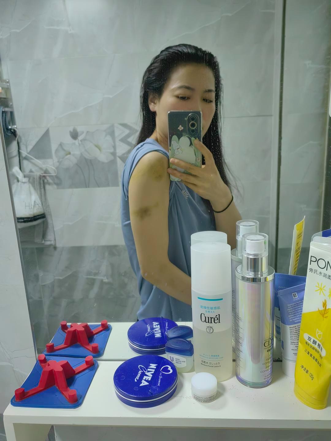 “女护士被男友杀害案”家属发现多张受害人身体淤青及烫伤自拍照