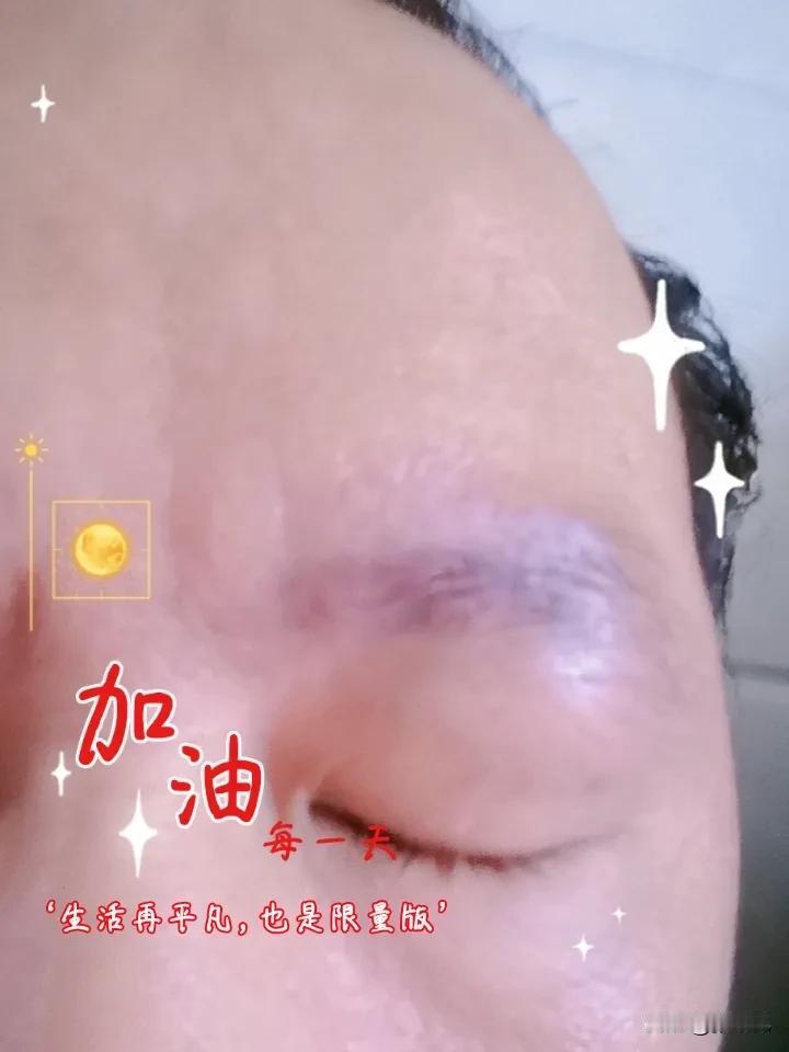 要不断的让眼睛得到充分的休息，不要长时间的盯着手机。
最好是看一秒闭眼一秒。