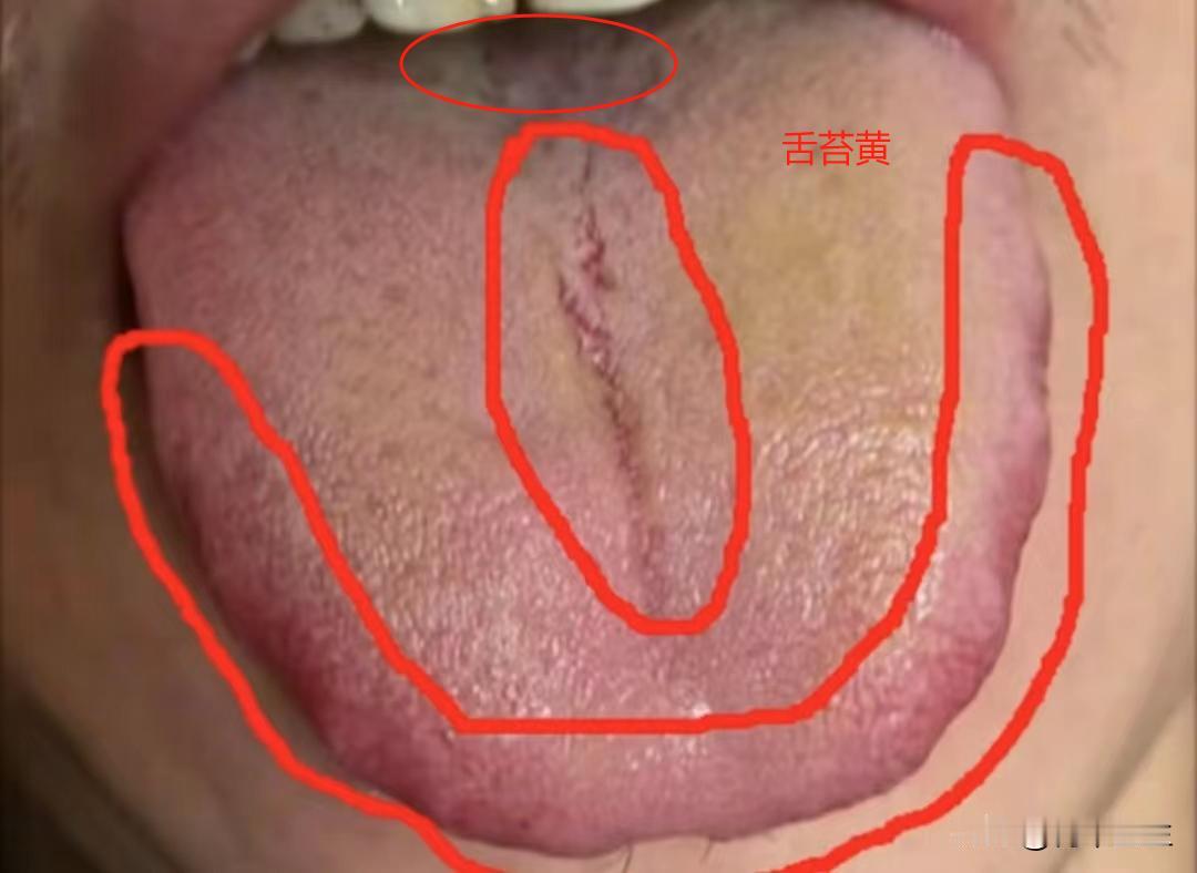 欲望强能力差，脾肾两虚的情况你可不能再补肾了，没效果还加重病情
患者主诉：腰膝酸
