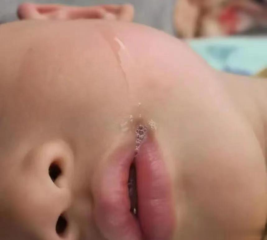 孩子积食，如何辨别？特别注意4看1摸1闻
 
1、看便便
大便干结、酸臭，排便时