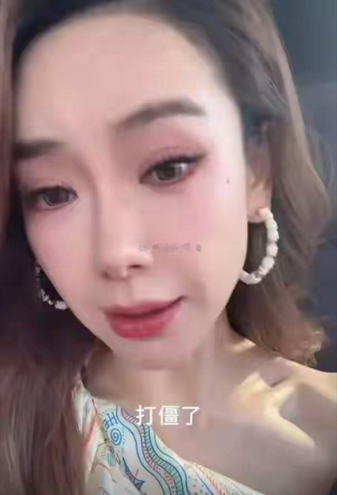戚薇自爆打肉毒打僵了， 整个眉毛完全动不了 早期的美真是一绝，所以我觉得一个人爱