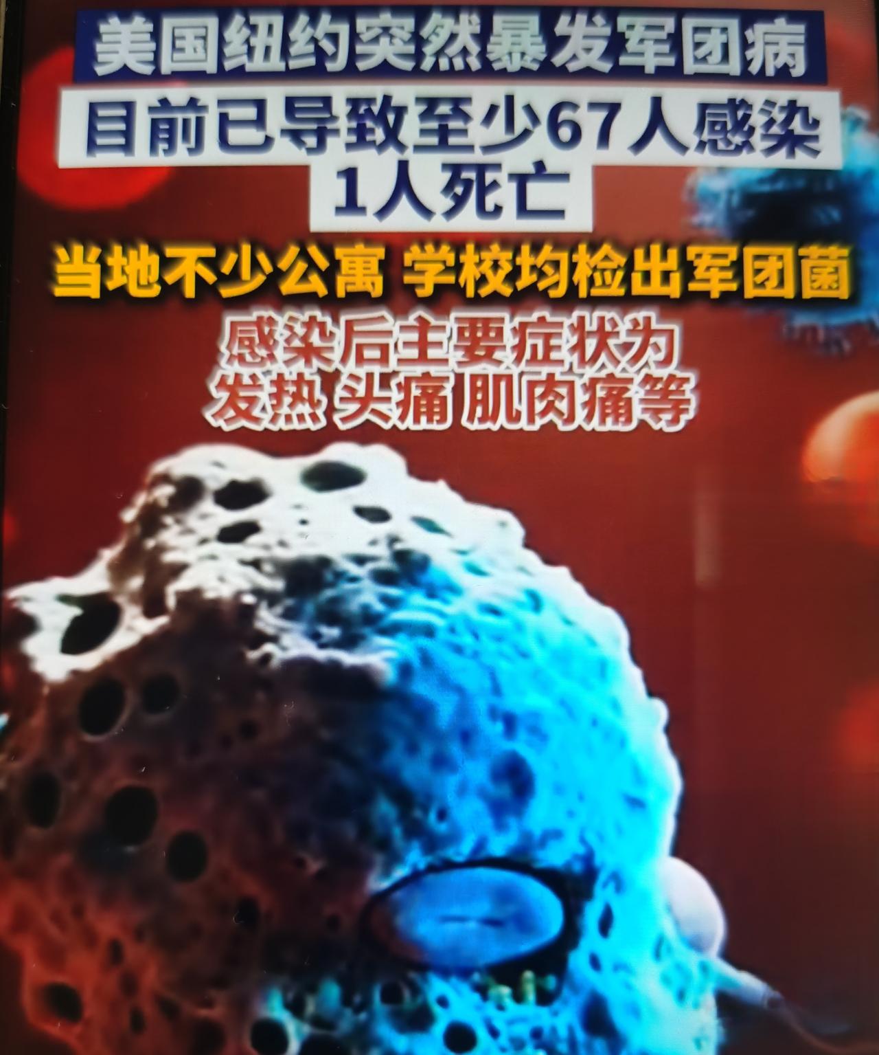 最近美国纽约曼哈顿上东区暴发军团病社区聚集性疫情，截至7月17日纽约市卫生局通报