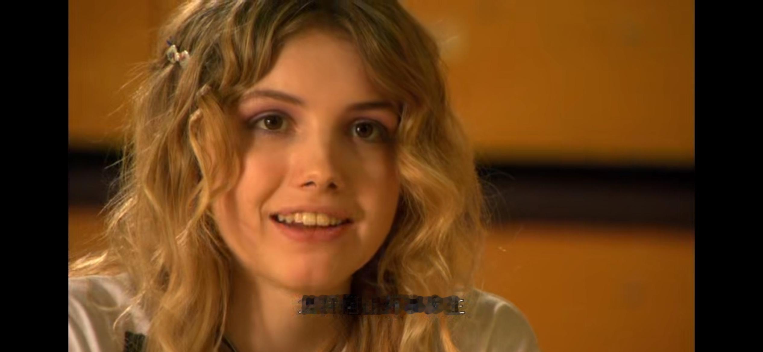 Skins 