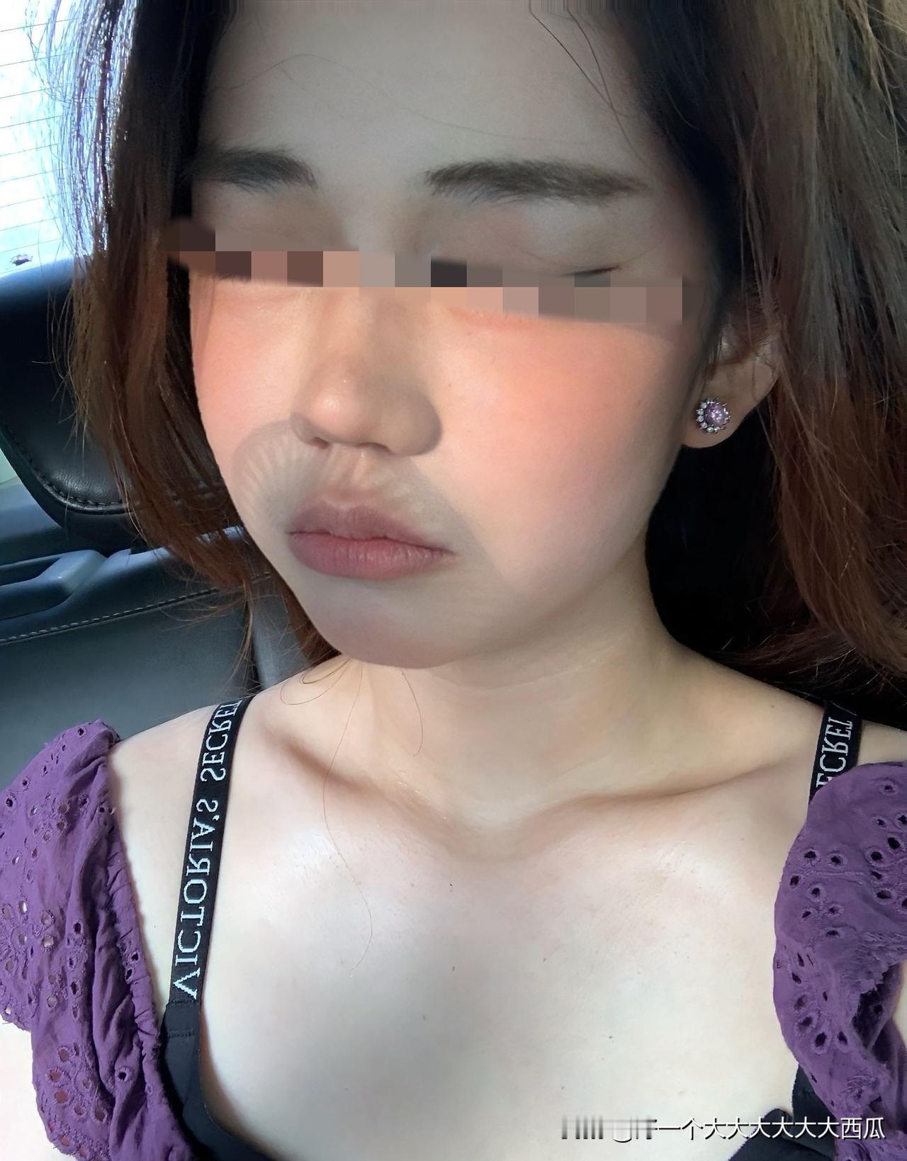 现在有些网红为了流量起号，
简直做到了毫无底线。
近日来自福建的女孩小熊称，
8
