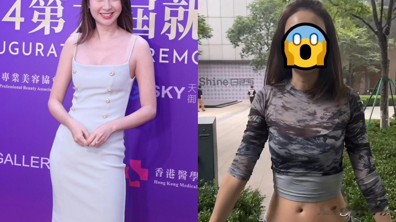 44岁隆胸女星整完面惊现大变样，口肿面肿被斥「人造人」竟这样回应！
44岁「马来