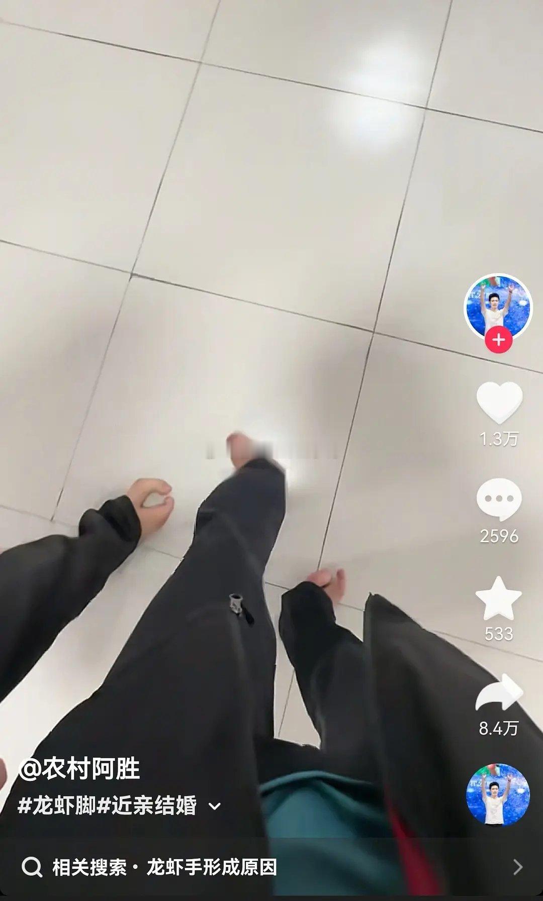 慎入：近亲结婚，太吓人了～😨😨 