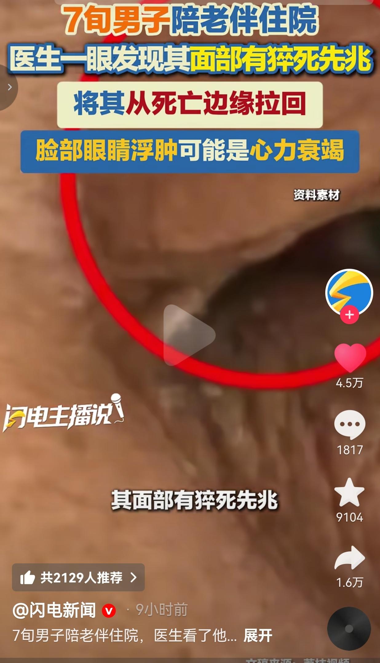 真的是后背发凉！医生就看了一眼陪床大爷的脸，直接把他从鬼门关拽了回来！

江苏南
