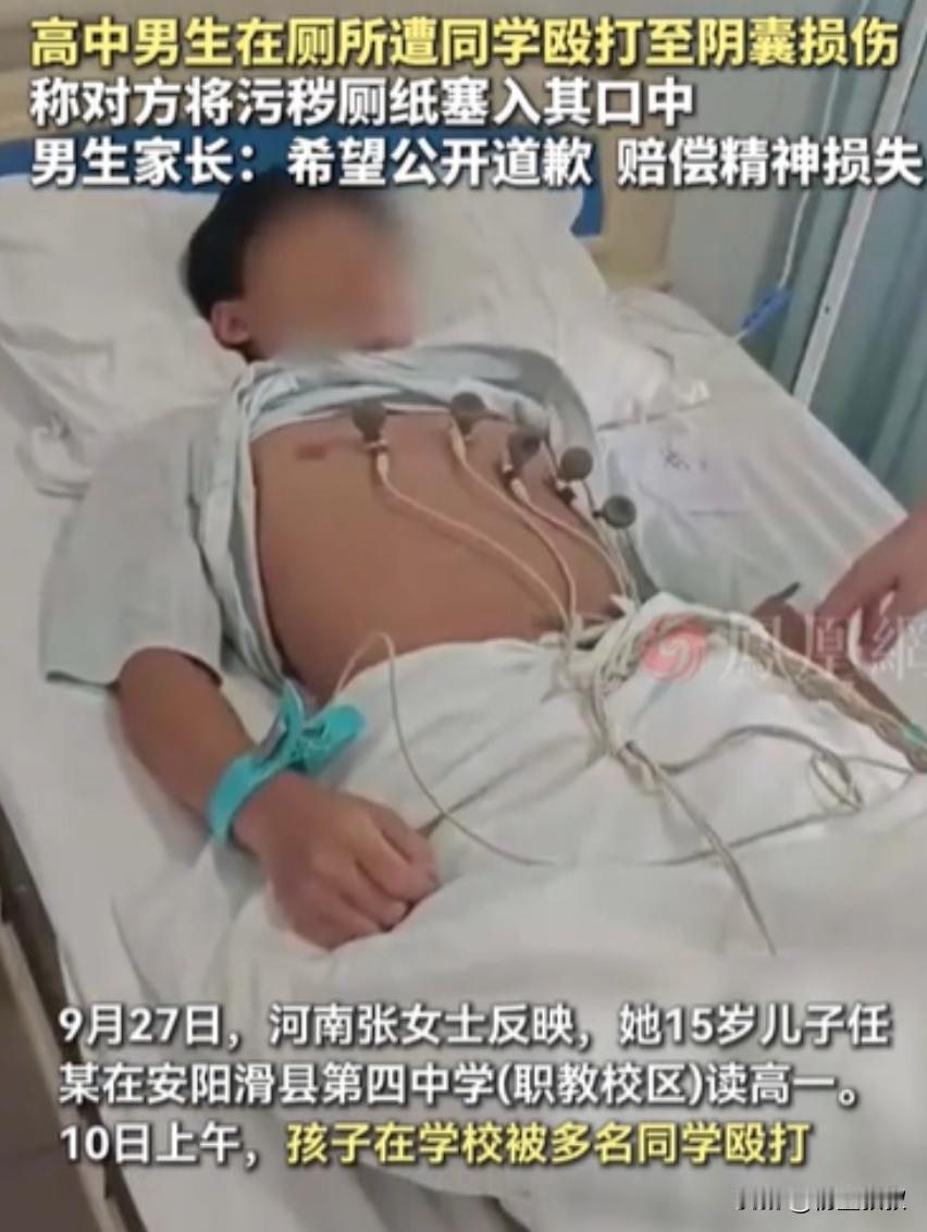 “太恶劣了！”河南安阳，一高中男孩因同学熄灯后说话打闹，影响他休息，便出言制止，