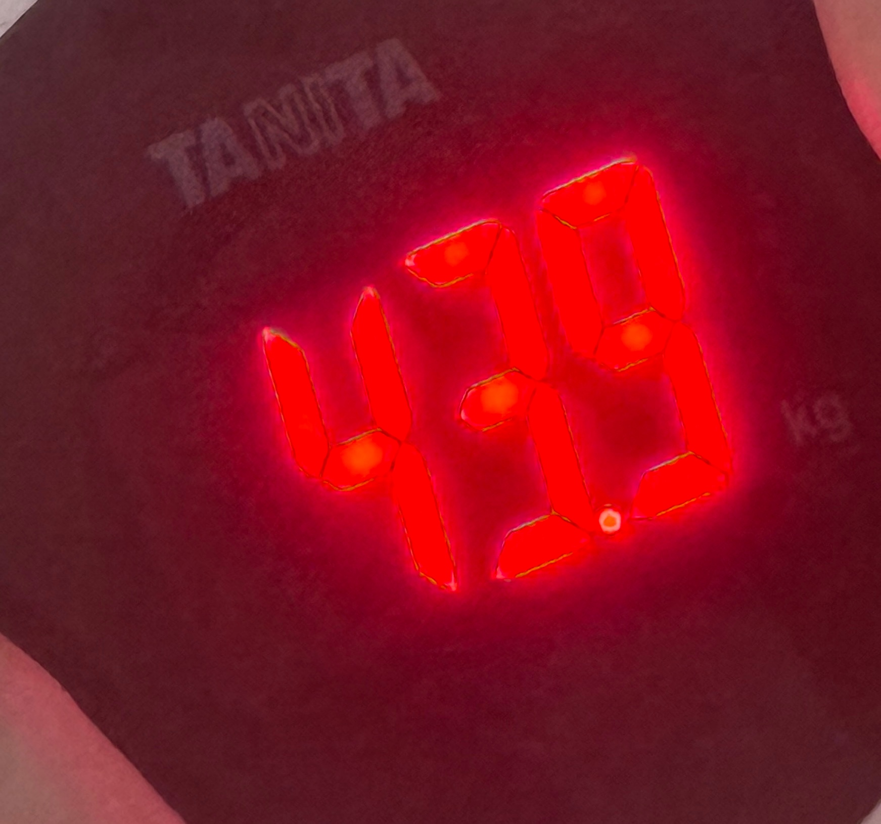 不用想了，人瘦了脸是肯定会垮的，只要你不做医美不打针的情况下就是会垮的，而且显老