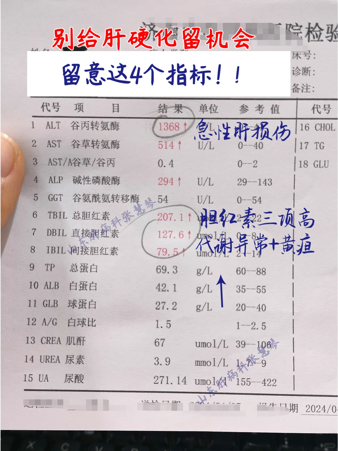 注意！别给肝硬化留机会，留意这4个指标↓