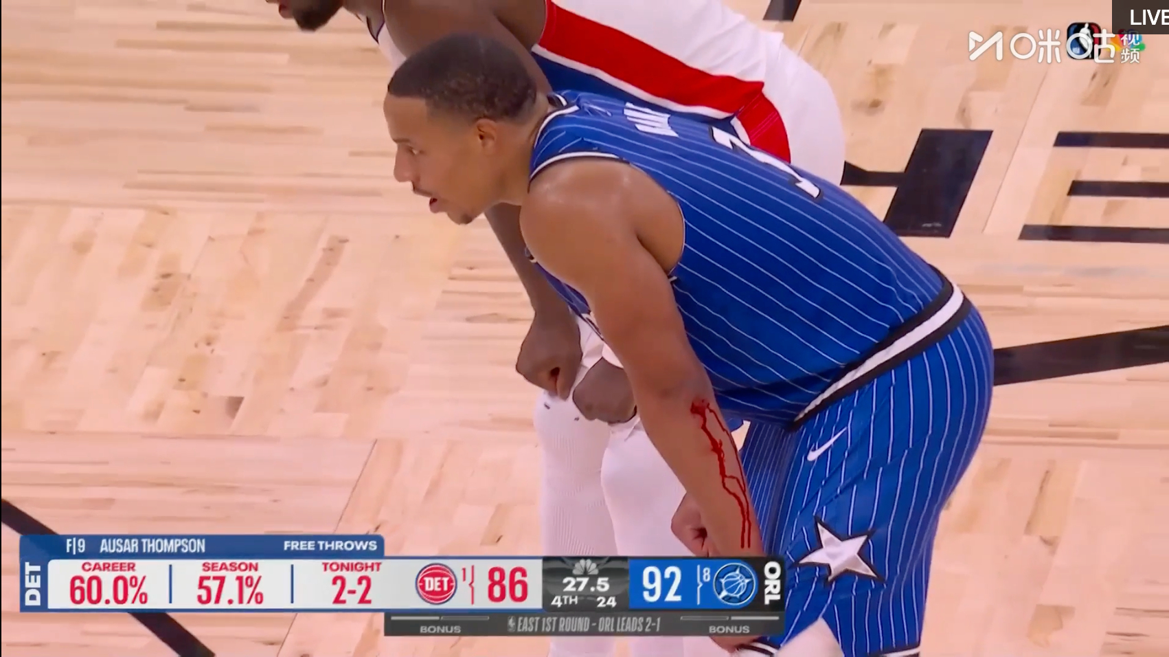 #贝恩手臂血流不止# 镜头给到贝恩手臂....血流不止#看NBA上咪咕#