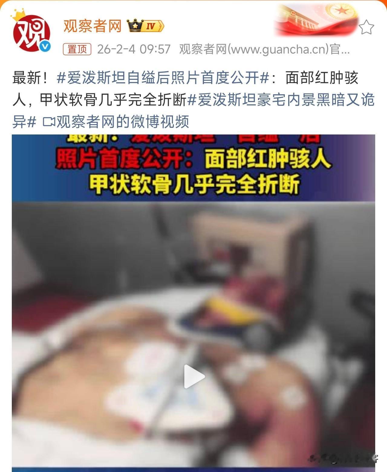 爱泼斯坦自缢后照片首度公开，第一，是否是爱泼斯坦本人？存疑！

第二，如果是本人