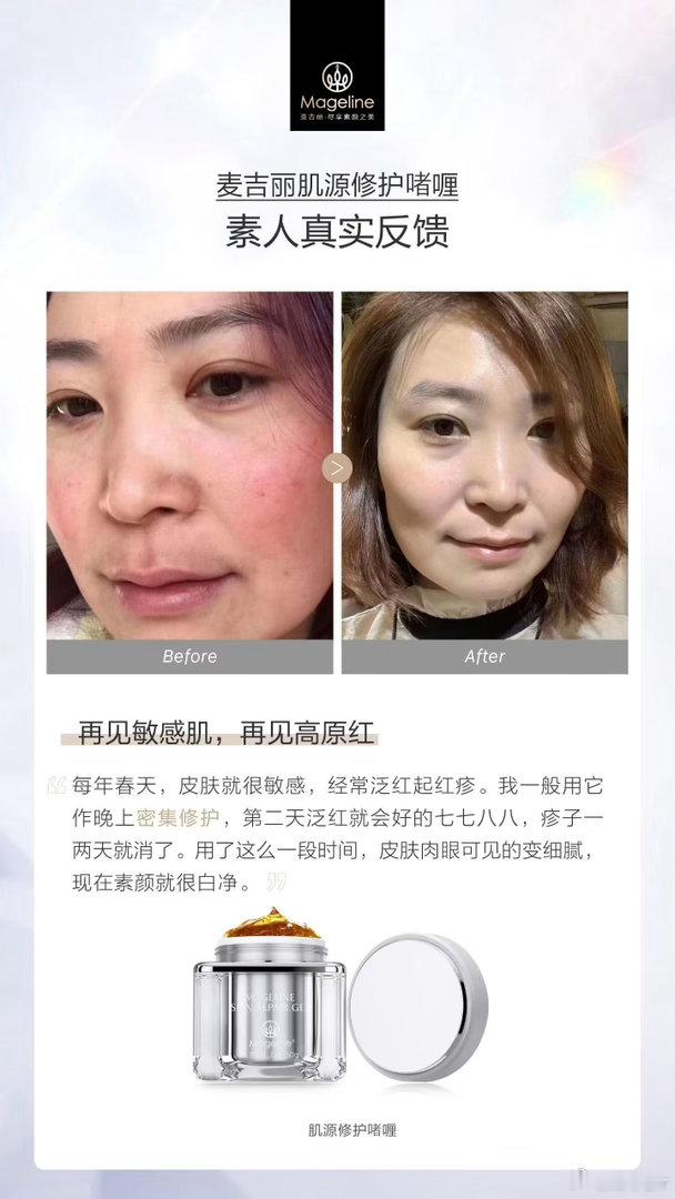 敏感肌｜角质层薄｜红血丝水养润护三部曲➕肌源修护啫喱 