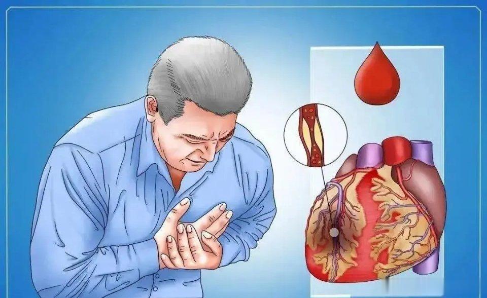 冠心病初期的9大症状，出现不要放过！1.左肩膀或者左侧后背疼2.突发性耳鸣或者耳