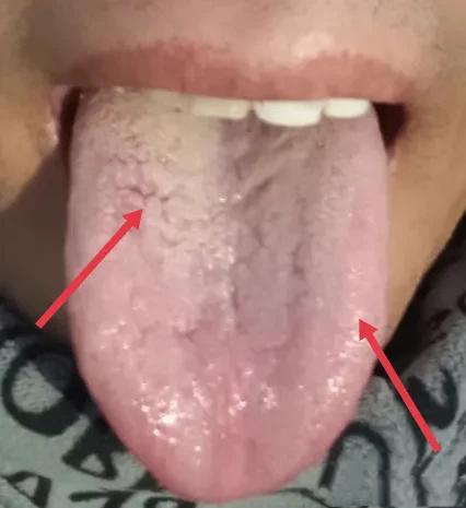 这种舌头，99%的人都认为是气血两虚、湿气重，但按这个思路调理，做再好也是白费功