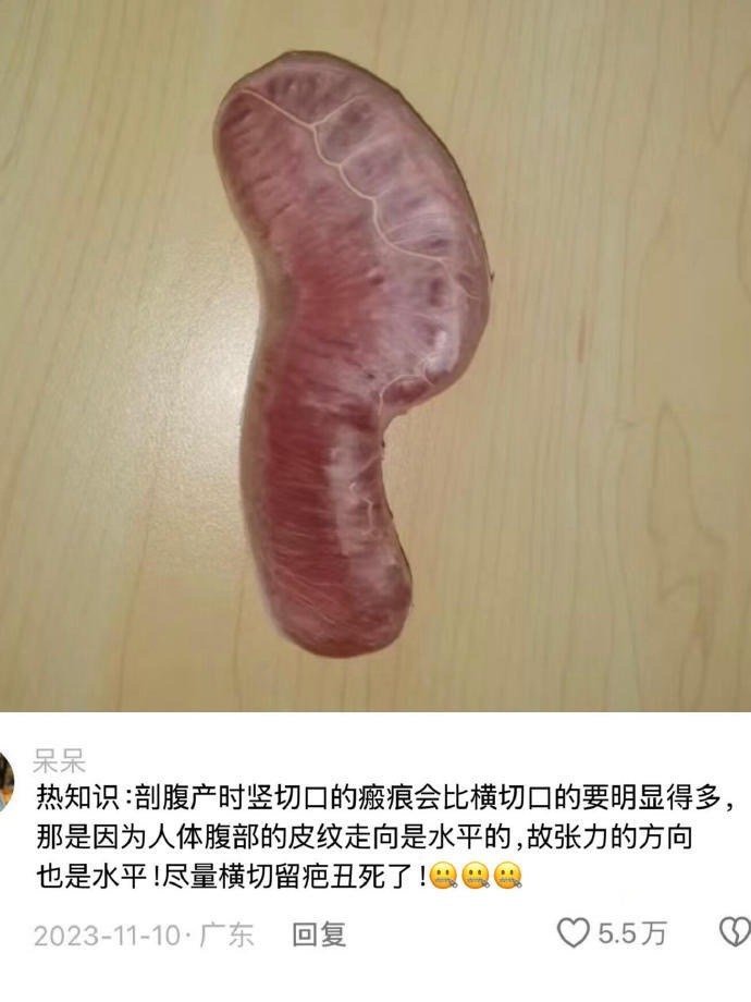 哦买噶。。第一次直观感受到生育对母体的损伤！ 