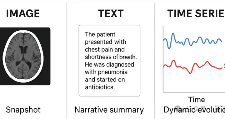 微軟發布醫療時序基座模型：4540億數據預訓練，解決不規則采樣